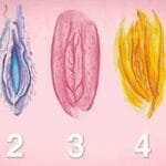 Tipos de vulva